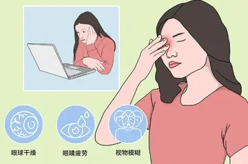 电脑综合征症状大揭秘：眼睛疲劳、颈部僵硬、手指酸痛、头痛等常见症状详解